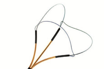 Stone Retrieval Basket, Gold, Open end, 3 Arm - Premium